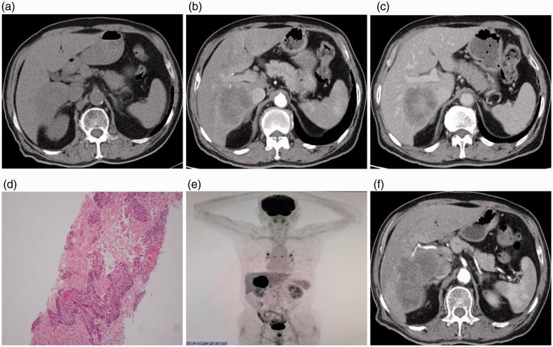 https://cdn.ncbi.nlm.nih.gov/pmc/blobs/490d/8216356/476507851c98/10.1177_03000605211021275-fig1.jpg