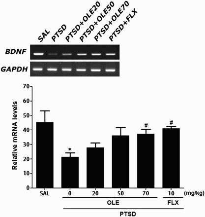 https://cdn.ncbi.nlm.nih.gov/pmc/blobs/490e/6138302/b56555d7b98f/TACS_A_1426699_F0007_B.jpg