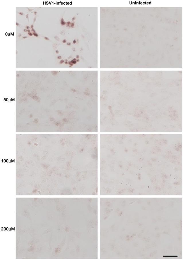 https://cdn.ncbi.nlm.nih.gov/pmc/blobs/4911/5845560/6daaf70fc2c0/fnagi-10-00048-g0010.jpg