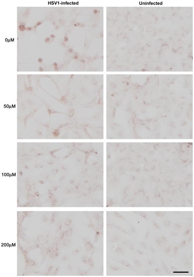 https://cdn.ncbi.nlm.nih.gov/pmc/blobs/4911/5845560/718eb28fd141/fnagi-10-00048-g0009.jpg
