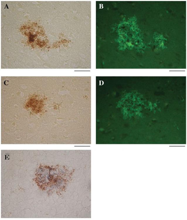 https://cdn.ncbi.nlm.nih.gov/pmc/blobs/4911/5845560/868c8e0cc1d4/fnagi-10-00048-g0006.jpg