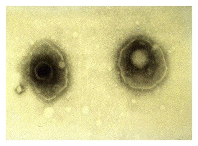 https://cdn.ncbi.nlm.nih.gov/pmc/blobs/4911/5845560/cf5bd56aecf1/fnagi-10-00048-g0001.jpg