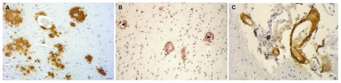https://cdn.ncbi.nlm.nih.gov/pmc/blobs/4911/5845560/f9bcab3f023d/fnagi-10-00048-g0008.jpg