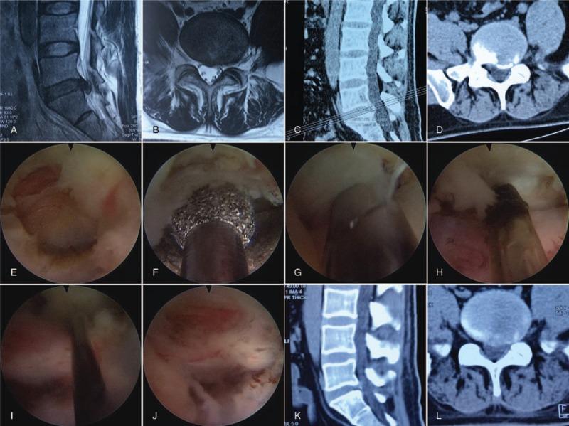 https://cdn.ncbi.nlm.nih.gov/pmc/blobs/4914/5944510/44578fa3e01a/medi-97-e0585-g003.jpg