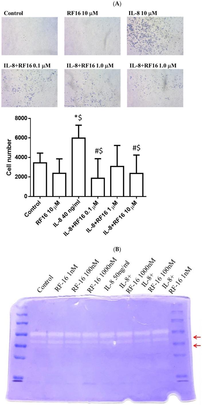 https://cdn.ncbi.nlm.nih.gov/pmc/blobs/4917/10531501/37241f70d9a8/ijms-24-14029-g005.jpg