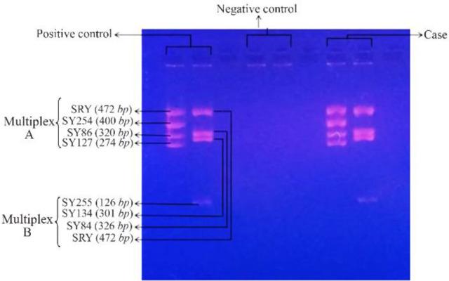 https://cdn.ncbi.nlm.nih.gov/pmc/blobs/4917/7648871/7240a8117c60/JRI-21-298-g003.jpg