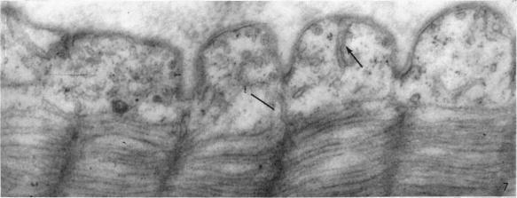 https://cdn.ncbi.nlm.nih.gov/pmc/blobs/4919/1231773/4e4d6282bc29/janat00403-0126-b.jpg