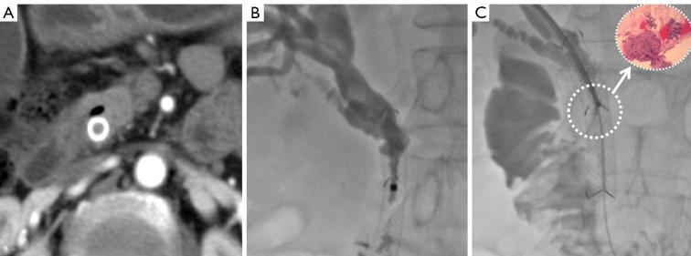 https://cdn.ncbi.nlm.nih.gov/pmc/blobs/4924/10102799/c8acfbc1dcbd/qims-13-04-2605-f4.jpg