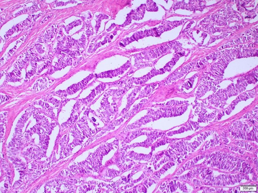 https://cdn.ncbi.nlm.nih.gov/pmc/blobs/4928/11921653/6c2020e6f885/13256_2025_5170_Fig4_HTML.jpg
