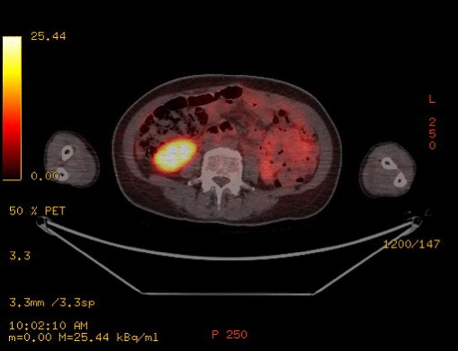 https://cdn.ncbi.nlm.nih.gov/pmc/blobs/4928/11921653/e3f6bc4e3d2b/13256_2025_5170_Fig6_HTML.jpg