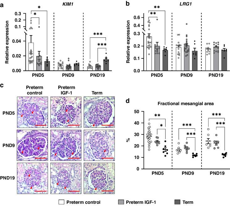 https://cdn.ncbi.nlm.nih.gov/pmc/blobs/492a/11772250/844b3a4edd4d/41390_2024_3222_Fig4_HTML.jpg