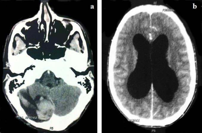 https://cdn.ncbi.nlm.nih.gov/pmc/blobs/493d/5417029/c1826c9d87b7/10.1177_2329048X14566813-fig2.jpg