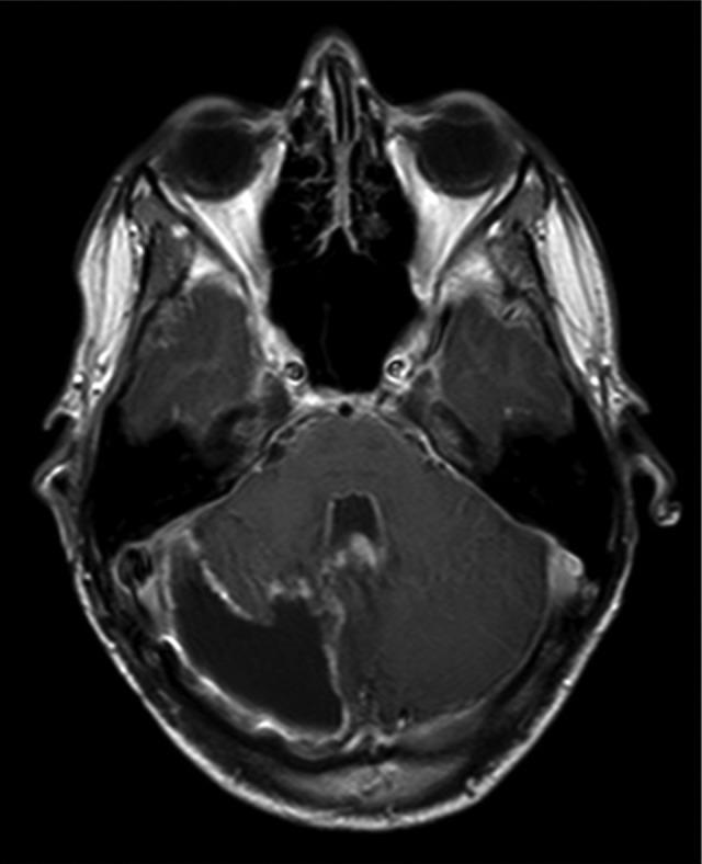 https://cdn.ncbi.nlm.nih.gov/pmc/blobs/493d/5417029/ffe6103351ba/10.1177_2329048X14566813-fig3.jpg