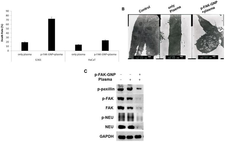 https://cdn.ncbi.nlm.nih.gov/pmc/blobs/4945/5666541/f3d61a92b1ba/ijmsv14p1101g005.jpg