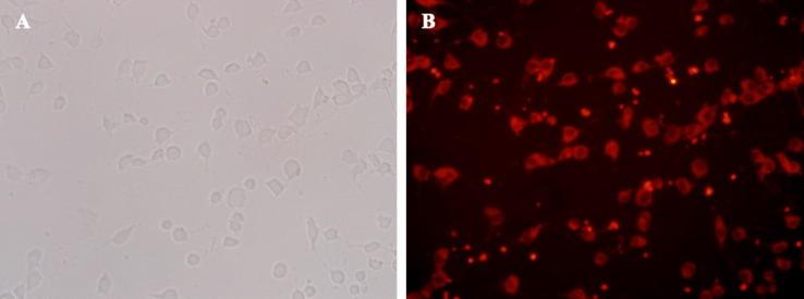 https://cdn.ncbi.nlm.nih.gov/pmc/blobs/4948/6978636/38cd0e53d354/gr11.jpg