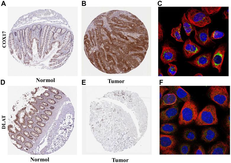 https://cdn.ncbi.nlm.nih.gov/pmc/blobs/4949/10756095/8e238ee3f09d/aging-15-205324-g007.jpg