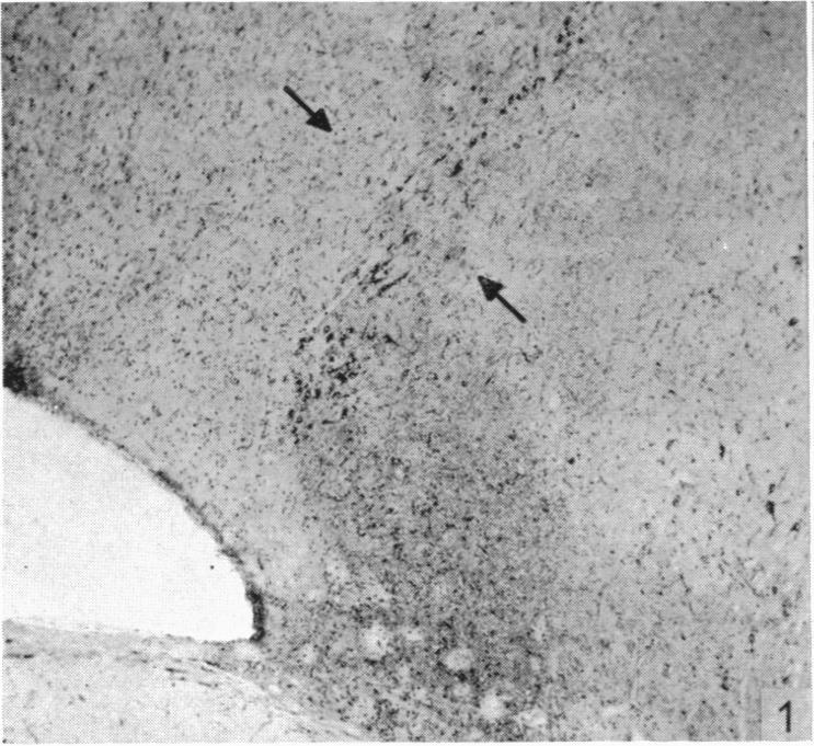 https://cdn.ncbi.nlm.nih.gov/pmc/blobs/494a/1244760/47ffb4dc2134/janat00461-0058-a.jpg