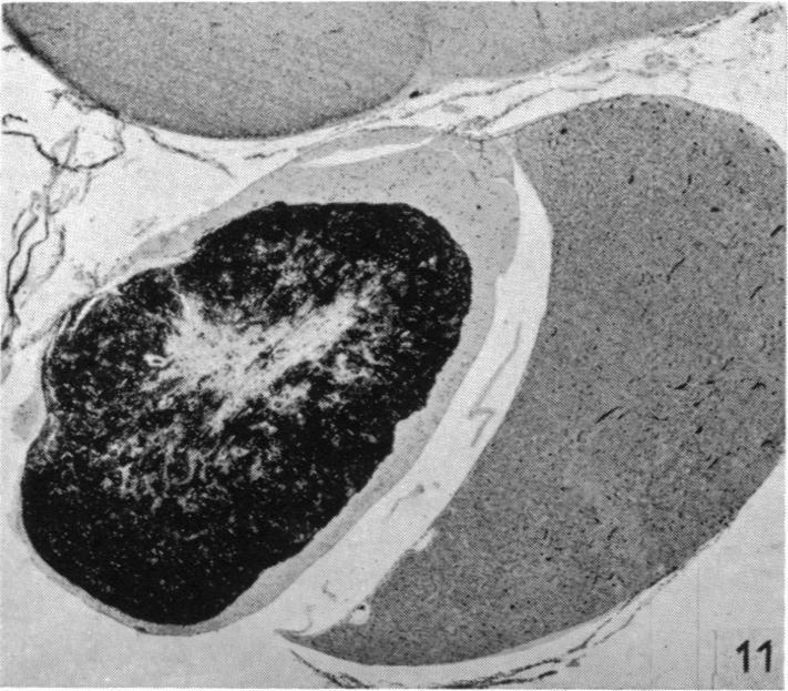 https://cdn.ncbi.nlm.nih.gov/pmc/blobs/494a/1244760/bc12923fe327/janat00461-0059-e.jpg