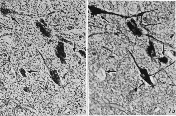 https://cdn.ncbi.nlm.nih.gov/pmc/blobs/494a/1244760/c4f8600195fe/janat00461-0059-a.jpg
