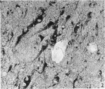 https://cdn.ncbi.nlm.nih.gov/pmc/blobs/494a/1244760/c8fac45a584e/janat00461-0058-b.jpg