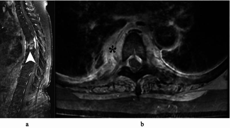 https://cdn.ncbi.nlm.nih.gov/pmc/blobs/4954/7717083/d1e8241c96cd/cureus-0012-00000011327-i02.jpg