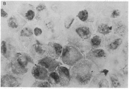 https://cdn.ncbi.nlm.nih.gov/pmc/blobs/4956/392108/855aae0b3cfb/pnas00623-0313-c.jpg