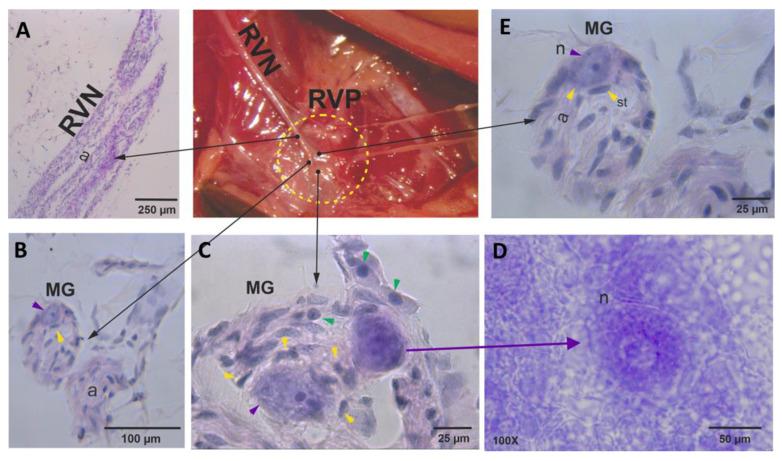 https://cdn.ncbi.nlm.nih.gov/pmc/blobs/495f/10377505/ed28f6401cc5/brainsci-13-01032-g002.jpg