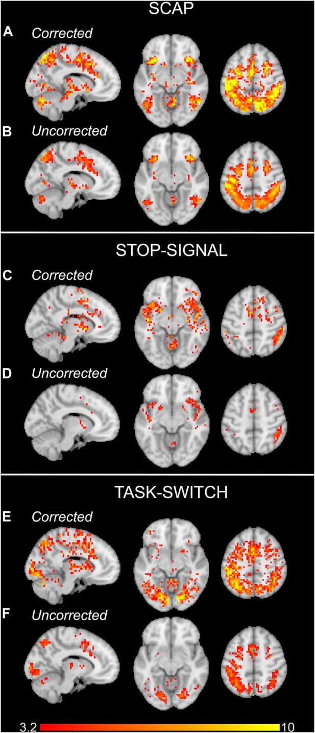https://cdn.ncbi.nlm.nih.gov/pmc/blobs/4961/10203231/15adca854b11/fphys-14-1167148-g003.jpg
