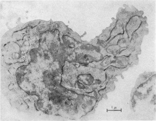 https://cdn.ncbi.nlm.nih.gov/pmc/blobs/4966/1456010/bc40d1a03e83/immunology00363-0195-a.jpg