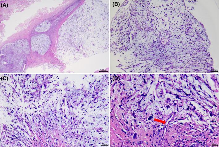 https://cdn.ncbi.nlm.nih.gov/pmc/blobs/496c/10870797/b25f7148cd84/CCR3-12-e8346-g004.jpg