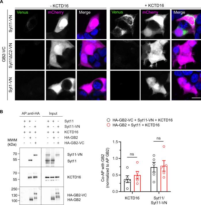 https://cdn.ncbi.nlm.nih.gov/pmc/blobs/4970/11169412/1e41b97d86be/44319_2024_147_Fig8_ESM.jpg