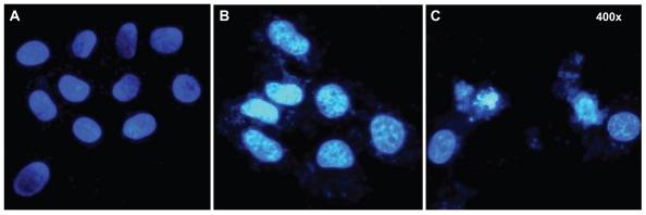https://cdn.ncbi.nlm.nih.gov/pmc/blobs/4974/3173051/2d592726ba4b/ijn-6-1889f4.jpg