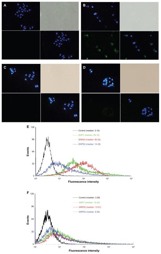 https://cdn.ncbi.nlm.nih.gov/pmc/blobs/4974/3173051/7434cebf5440/ijn-6-1889f2.jpg