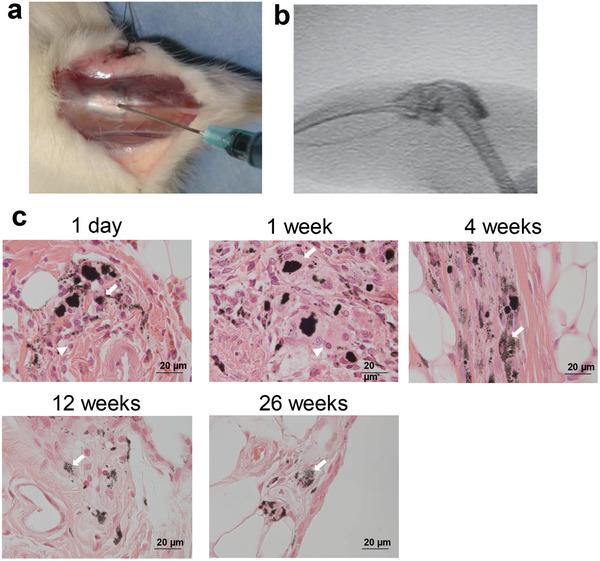 https://cdn.ncbi.nlm.nih.gov/pmc/blobs/4975/9404397/11dc187301db/ADVS-9-2201214-g004.jpg