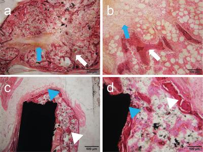 https://cdn.ncbi.nlm.nih.gov/pmc/blobs/4975/9404397/8aef93e06577/ADVS-9-2201214-g008.jpg