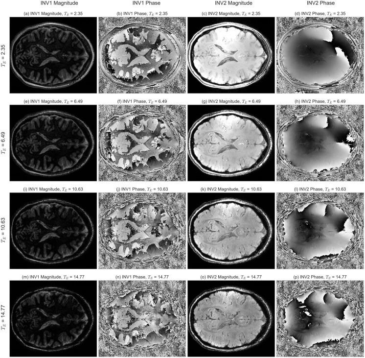 https://cdn.ncbi.nlm.nih.gov/pmc/blobs/4979/5230783/a16118812c16/pone.0169265.g005.jpg