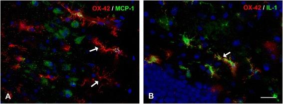 https://cdn.ncbi.nlm.nih.gov/pmc/blobs/497b/4180960/33e363d161f3/40478_2014_9142_Fig11_HTML.jpg