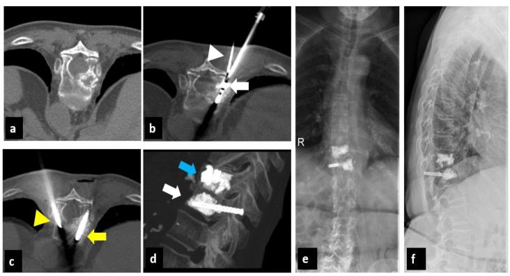 https://cdn.ncbi.nlm.nih.gov/pmc/blobs/497c/9955473/60ed1709ebe0/curroncol-30-00127-g003.jpg