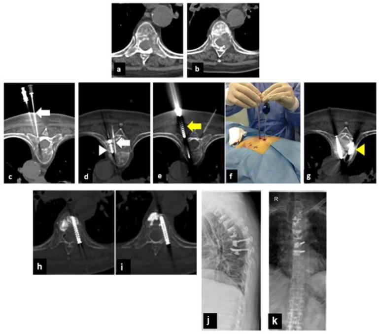 https://cdn.ncbi.nlm.nih.gov/pmc/blobs/497c/9955473/a2827af05577/curroncol-30-00127-g001.jpg