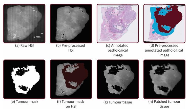 https://cdn.ncbi.nlm.nih.gov/pmc/blobs/497e/8946803/0d771e235506/cancers-14-01422-g002.jpg