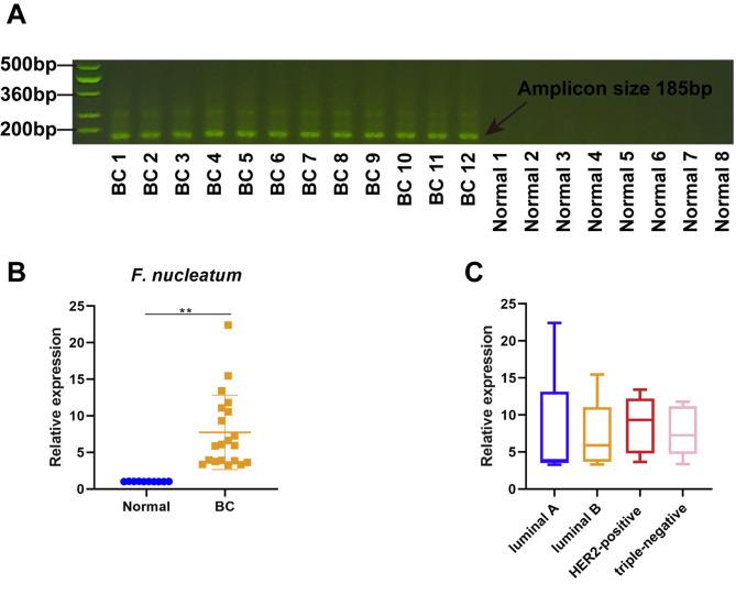 https://cdn.ncbi.nlm.nih.gov/pmc/blobs/4983/10207721/3bfed1976d64/12885_2023_10844_Fig1_HTML.jpg