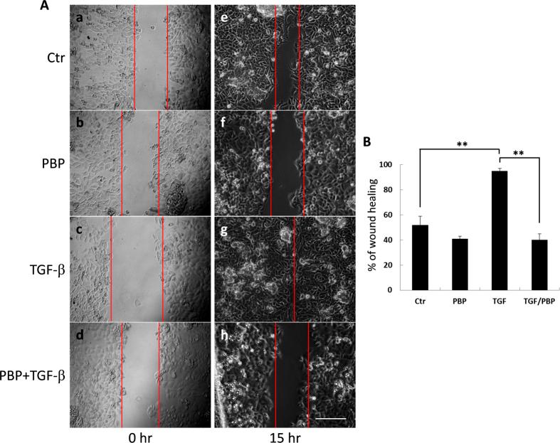 https://cdn.ncbi.nlm.nih.gov/pmc/blobs/4985/5322341/6e106029d6d5/srep43206-f4.jpg