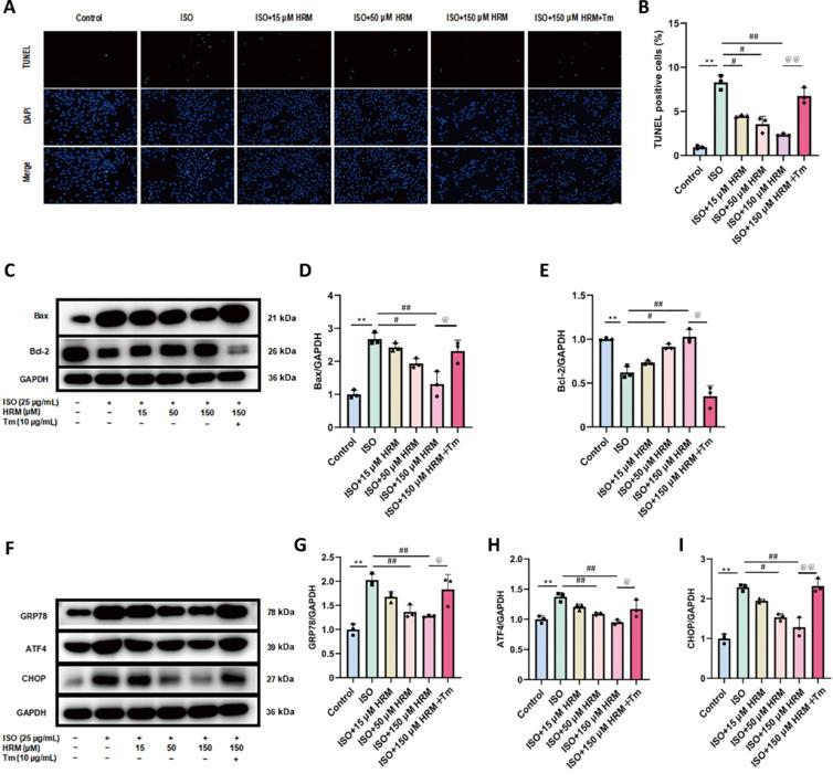 https://cdn.ncbi.nlm.nih.gov/pmc/blobs/4987/12124708/225816777c6d/MGR-15-459-g007.jpg
