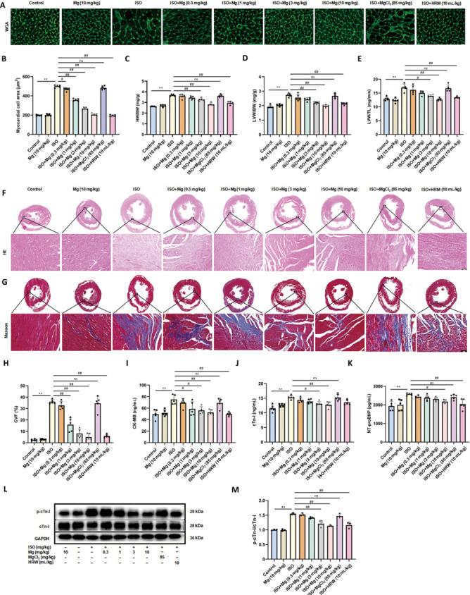 https://cdn.ncbi.nlm.nih.gov/pmc/blobs/4987/12124708/5acdc288392a/MGR-15-459-g003.jpg