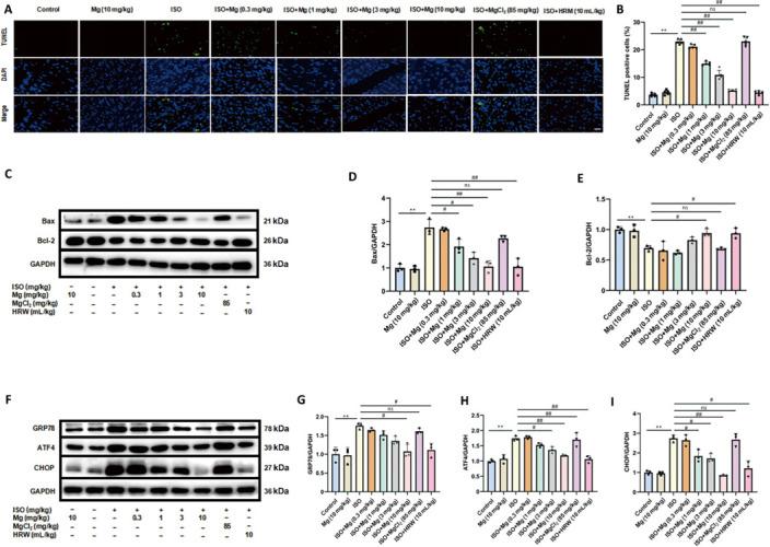 https://cdn.ncbi.nlm.nih.gov/pmc/blobs/4987/12124708/a7b7a91c6762/MGR-15-459-g004.jpg