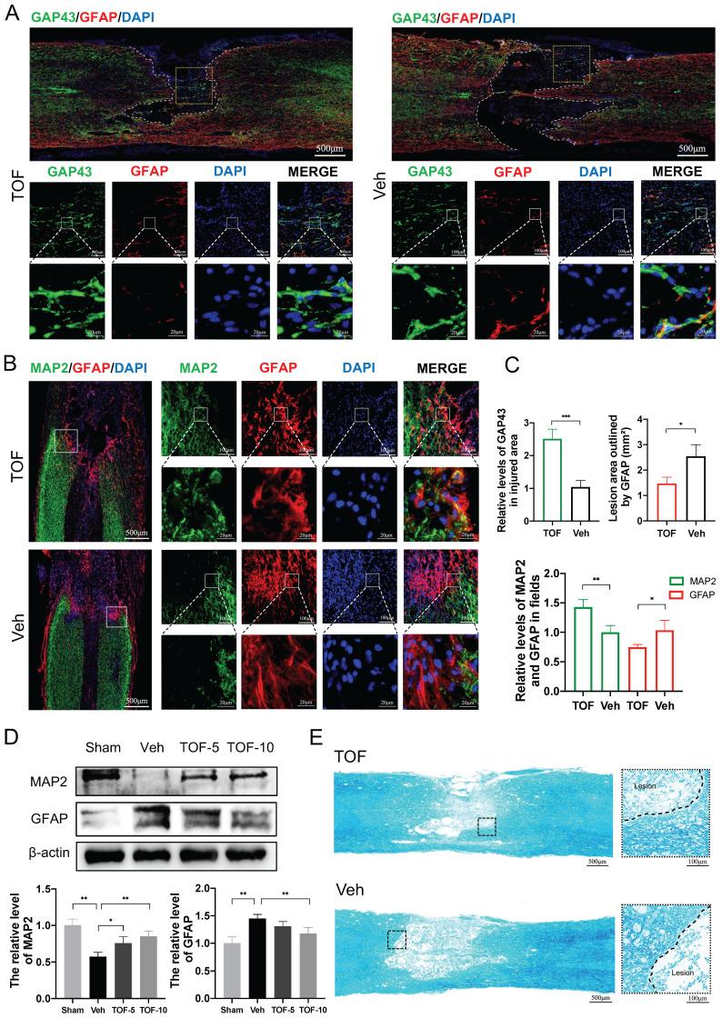 https://cdn.ncbi.nlm.nih.gov/pmc/blobs/4989/10539697/69de58ad36ab/ijbsv19p4865g003.jpg
