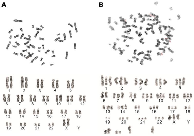 https://cdn.ncbi.nlm.nih.gov/pmc/blobs/498d/3858282/216136f1b8ee/pone.0081844.g006.jpg