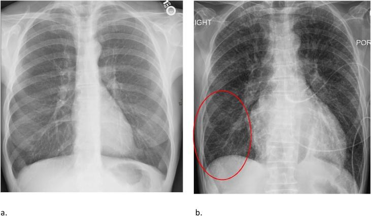 https://cdn.ncbi.nlm.nih.gov/pmc/blobs/499b/7607415/3cca3a0bc2c0/gr5.jpg