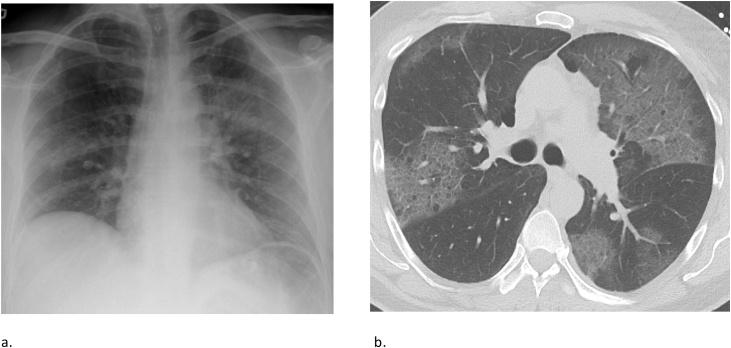 https://cdn.ncbi.nlm.nih.gov/pmc/blobs/499b/7607415/5010f8f5d87e/gr20.jpg