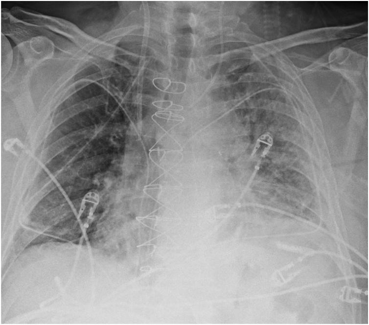 https://cdn.ncbi.nlm.nih.gov/pmc/blobs/499b/7607415/73d80946adbd/gr18.jpg
